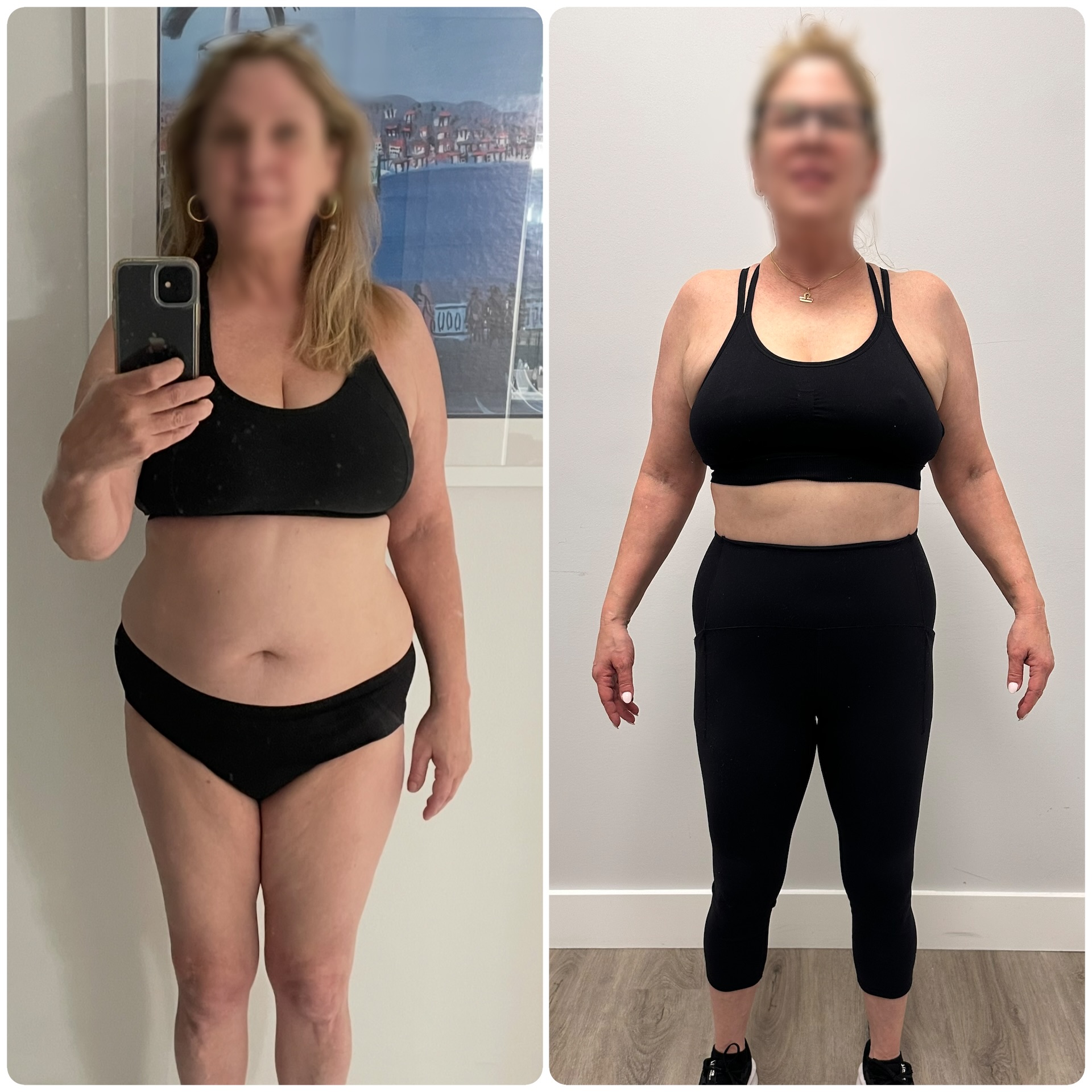 Anne G. transformation